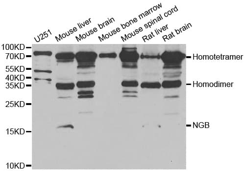 NGB / Neuroglobin Antibody