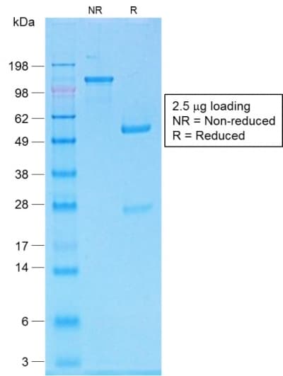 PathPlus™ MLANA / Melan-A Antibody (clone MLANA/1761R)