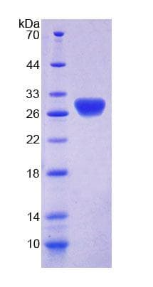 Mouse RTBDN / Retbindin Protein (Recombinant 6His, N-terminus)