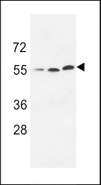 Polyclonal Rabbit anti-Human UCKL1 Antibody (aa60-90, IHC, WB)