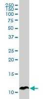 IHC-plus™ SPINK1 Antibody (clone 4D4)