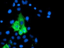 Monoclonal Mouse anti-Human ALOX15 / 15-Lipoxygenase Antibody (clone OTI3G8, IHC, IF, WB)