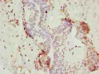NOP10 Antibody
