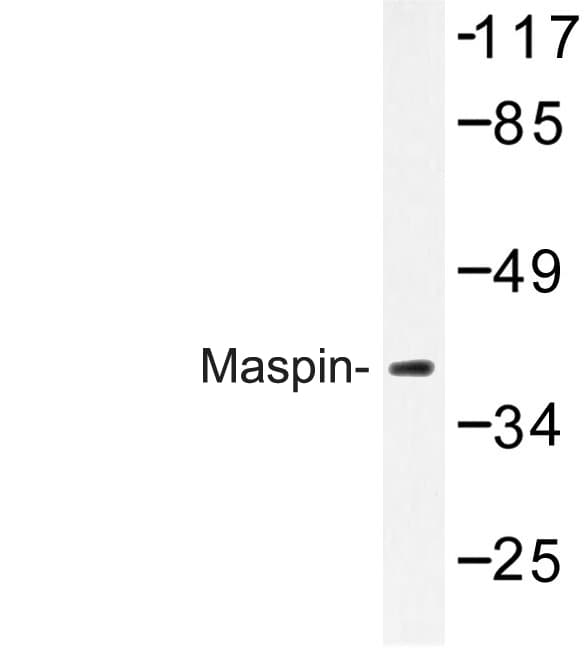 SERPINB5 / Maspin Antibody (Thr118)