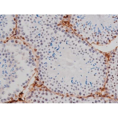 Polyclonal Rabbit anti-Human MAPT / Tau Antibody (phospho-Thr205, IHC, WB)