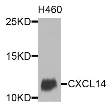 Polyclonal Rabbit anti-Human BRAK / CXCL14 Antibody (WB)