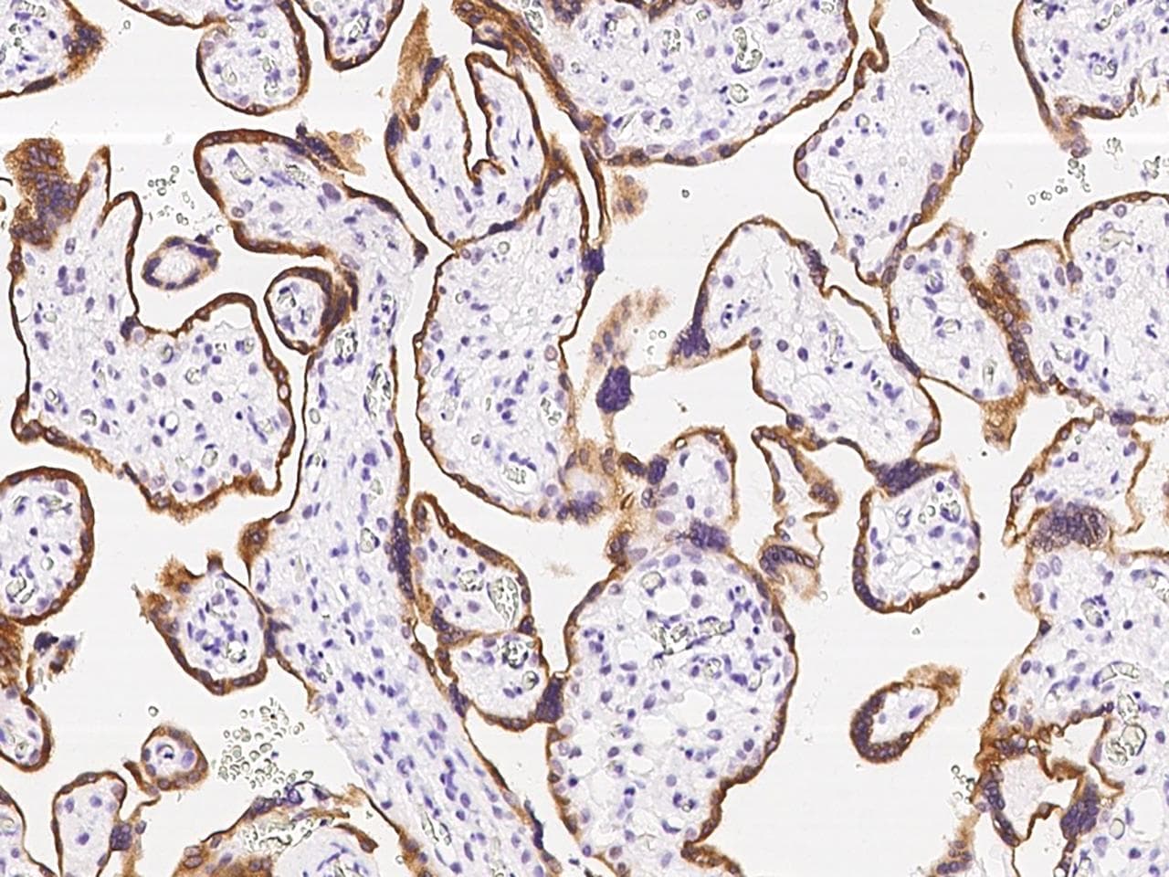 Polyclonal Rabbit anti-Human CYP19 / Aromatase Antibody (IHC)