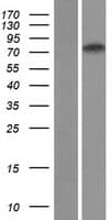 ZNF471 Protein (Over-Expression Lysate Myc-DDK (Flag))