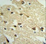 ADCY8 / Adenylate Cyclase 8 Antibody (aa946-972)