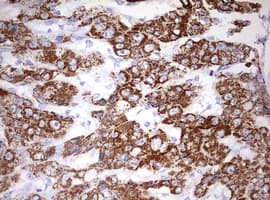 OTC Antibody (aa33-354, clone OTI5A7)