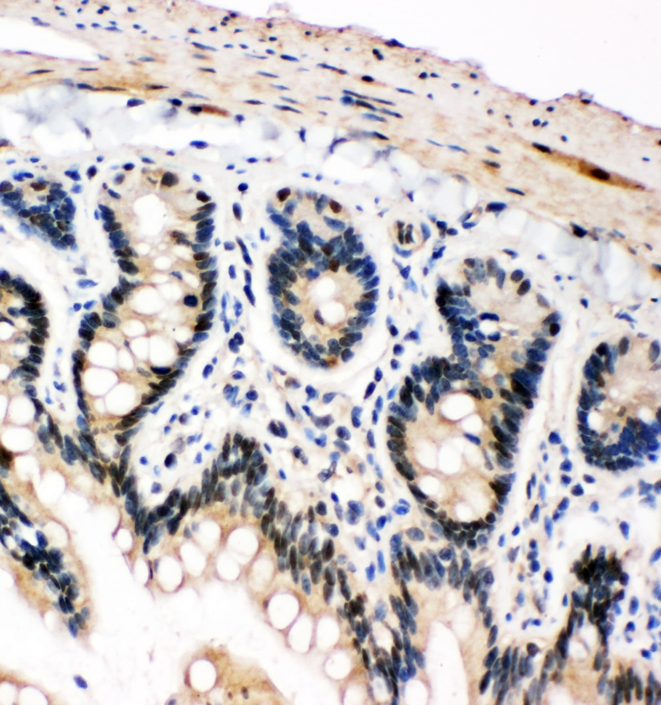 SNK / PLK2 Antibody (aa666-685)