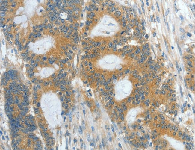 Polyclonal Rabbit anti-Human ASPA Antibody (IHC, WB)