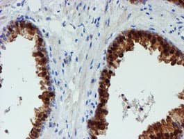 PGM3 Antibody (clone OTI1A11)
