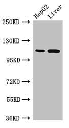 TMPRSS15 / Enterokinase Antibody