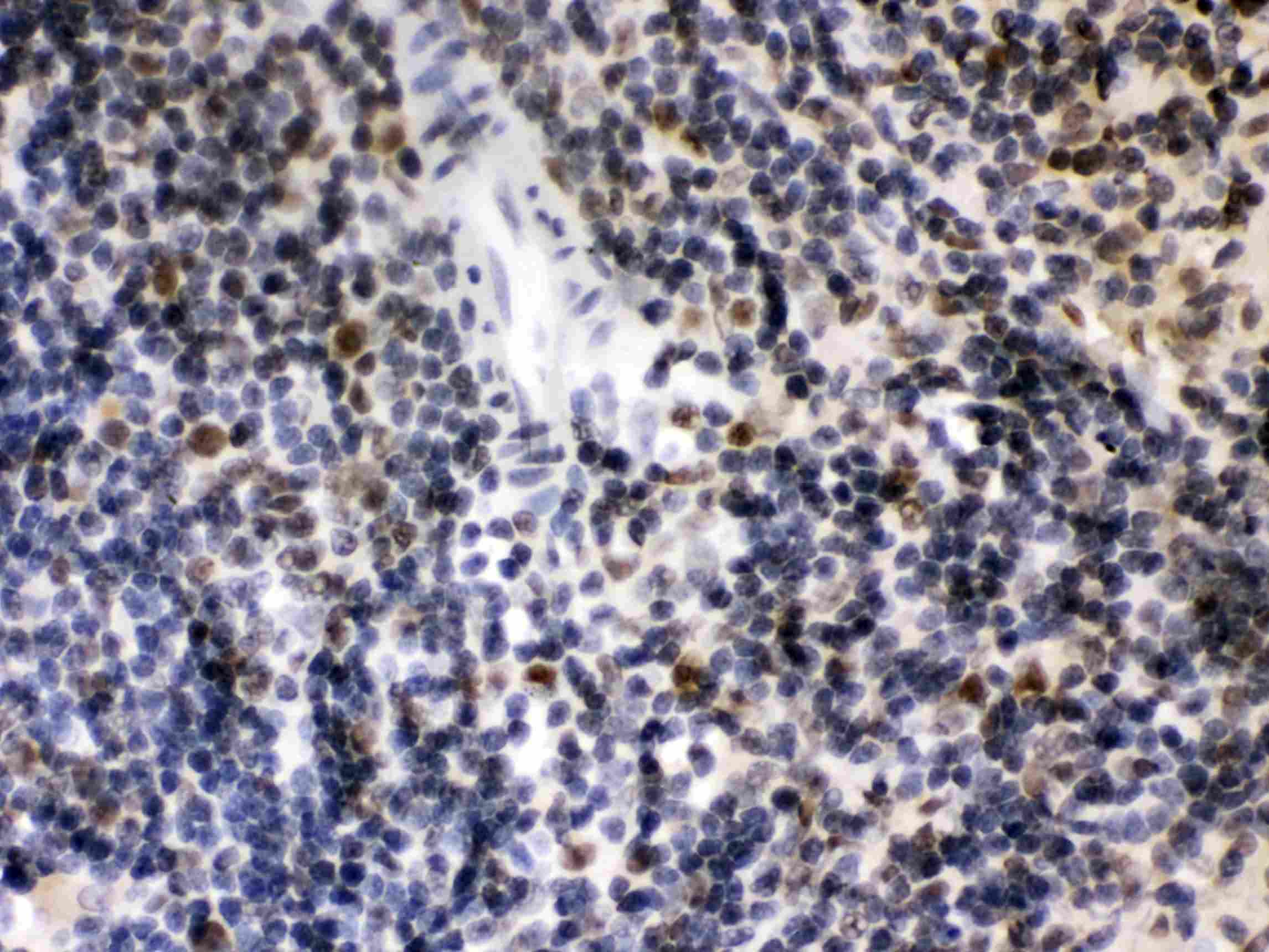 CIITA Antibody