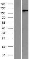 Human RNF20 Protein (Over-Expression Lysate Myc-DDK (Flag))