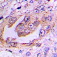 KIF11 / EG5 Antibody (C-Terminus)