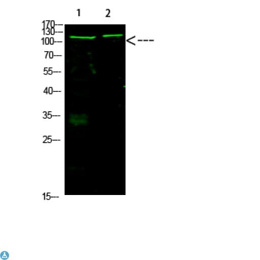 RB1 / Retinoblastoma / RB Antibody