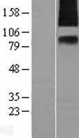 SV2A / SV Protein (Over-Expression Lysate Myc-DDK (Flag))