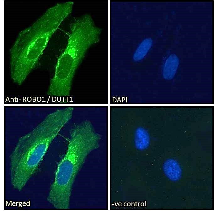 IHC-plus™ ROBO1 Antibody (aa994-1006)