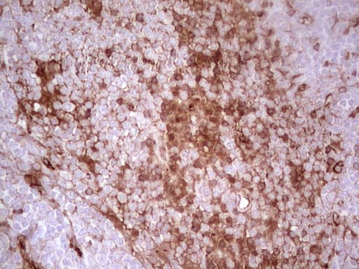 Adiponectin Antibody (aa19-244, clone OTI3G10)