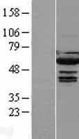 IRF5 Protein (Over-Expression Lysate Myc-DDK (Flag))