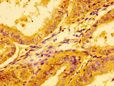 LDHA / LDH1 Antibody