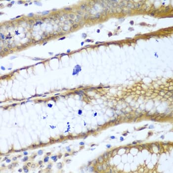 Rho Kinase / ROCK1 Antibody