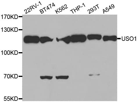 US01 / p115 Antibody