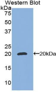 CEBPG / CEBP Gamma Antibody (aa1-150)