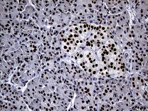 Monoclonal Mouse anti-Human TP53BP1 / 53BP1 Antibody (clone OTI6D9, aa1-300, IHC, WB)