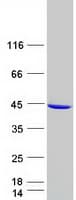 Human GALM / Mutarotase Protein (Recombinant Myc-DDK (Flag))