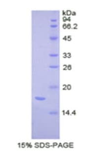 Human CPLX2 / Complexin 2 Protein (Recombinant His)