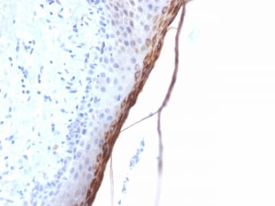 FLG / Filaggrin Antibody (aa 198-288, clone FLG/1957R)