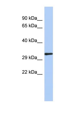 Polyclonal Rabbit anti-Human NKX2-2 Antibody (N-Terminus, WB)