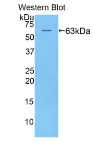 KIR2DL2 / CD158b Antibody (aa22-348)