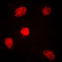 IHC-plus™ MED1 / TRAP220 Antibody (Internal)