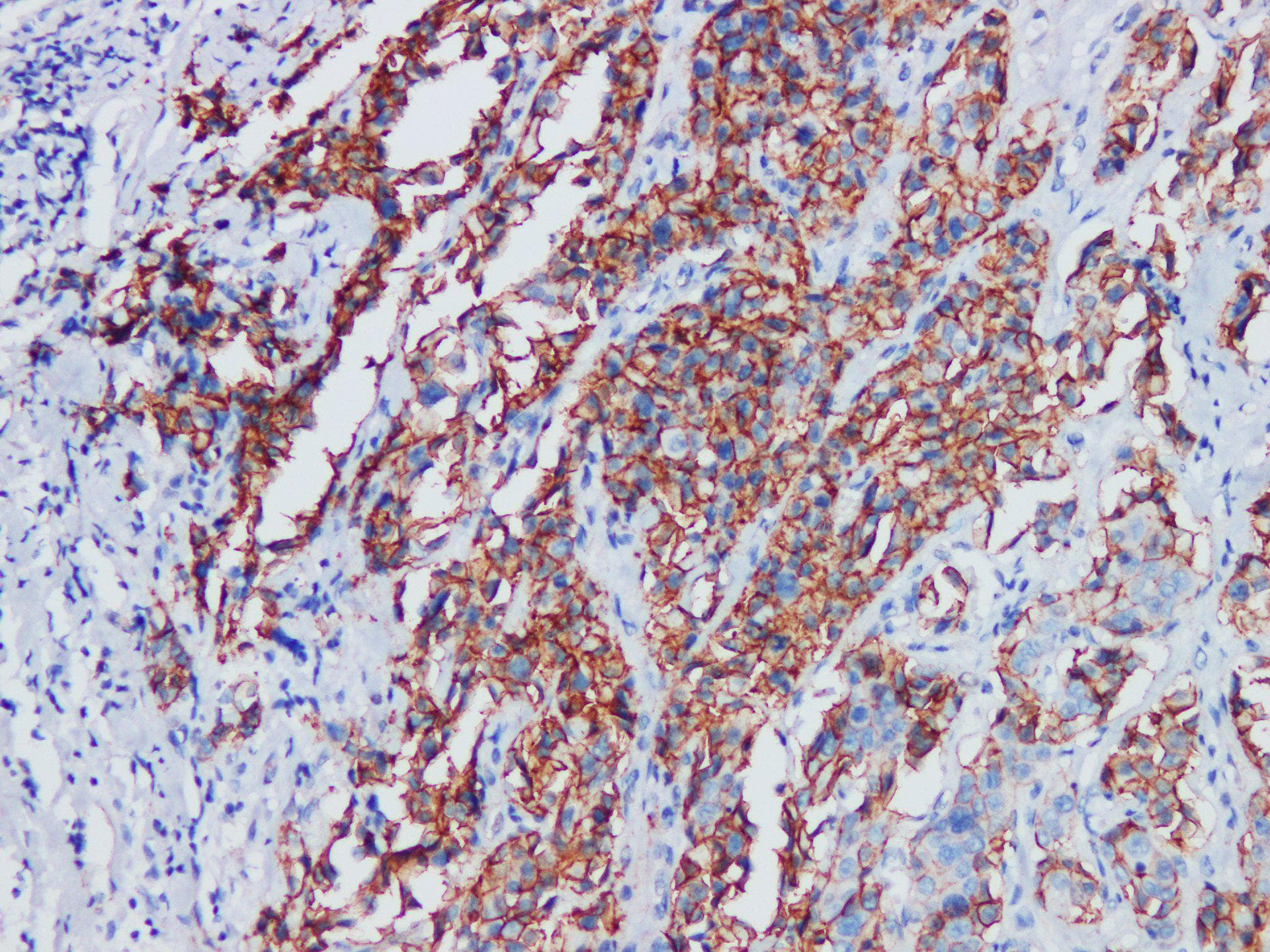 BRD8 Antibody