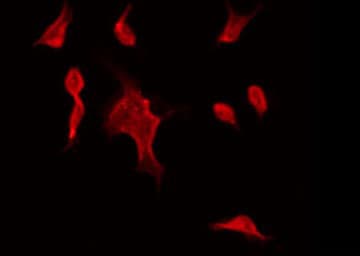 STK32C / PKE Antibody