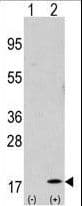 Polyclonal Rabbit anti-Human GABARAP Antibody (aa1-30, IHC, IF, WB)