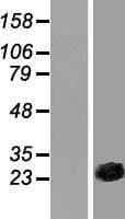 Human CSRP3 Protein (Over-Expression Lysate Myc-DDK (Flag))