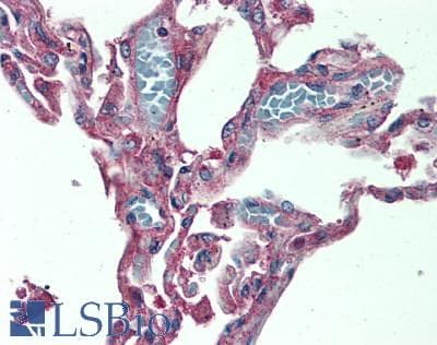 IHC-plus™ LIMK1 / LIMK Antibody (aa597-647)