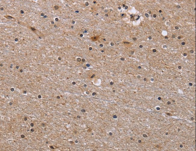 GABPB2 Antibody