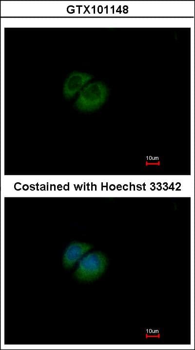 HPRT1 / HPRT Antibody (aa1-218)