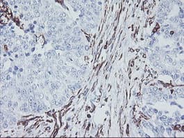 KIF2C / MCAK Antibody (clone OTI1C5)