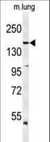 Polyclonal Rabbit anti-Human KDR / VEGFR2 / FLK1 Antibody (Tyr1175, WB)