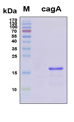 H. pylori CagA Protein (Recombinant 6His, N-terminus)