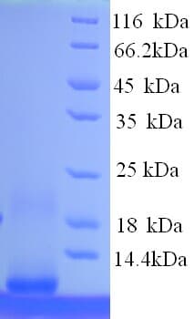Human MT1F Protein (Recombinant His)