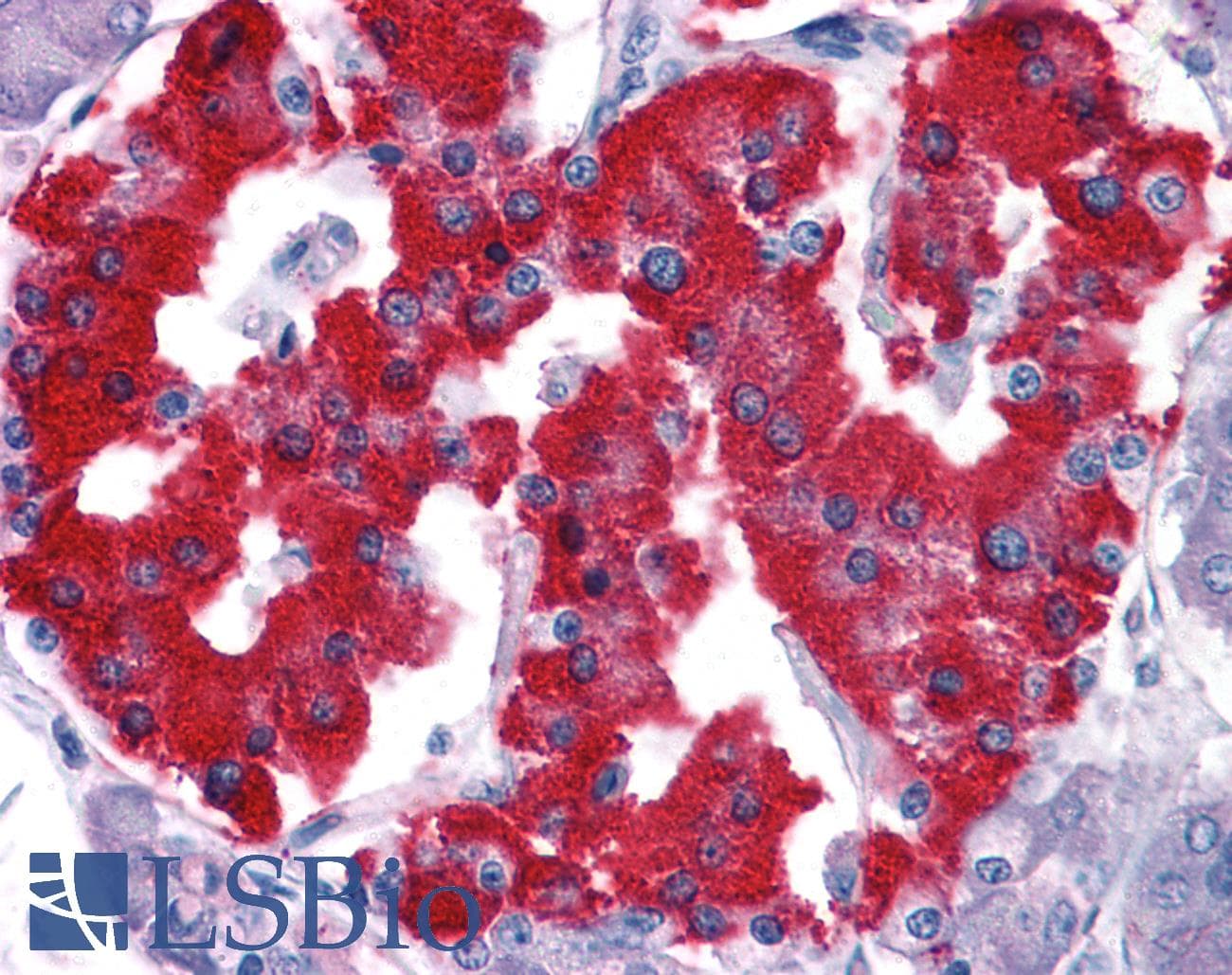 IHC-plus™ VTCN1 / B7-H4 Antibody (clone H74)