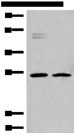 Polyclonal Rabbit anti-Human HLA-DMB Antibody (IHC, WB)